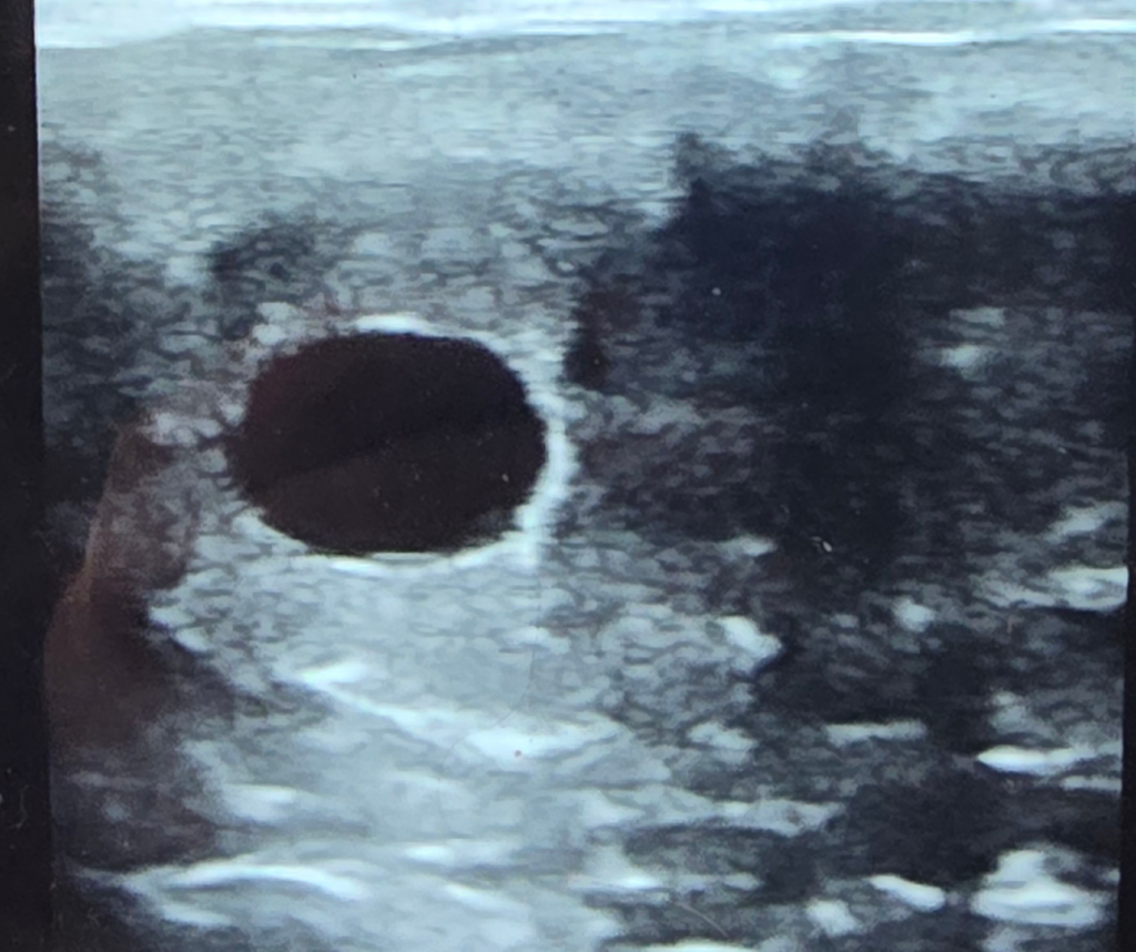 Disarm First Foal Sonogram